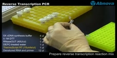 Reverse Transcription PCR