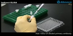 Plasmid DNA Extraction (Miniprep)
