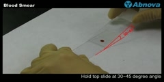 Blood Smear