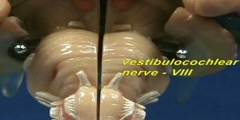 Brain Stem Model - Inferior View II - Medulla & Cranial Nerv