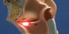 Bronchial Tree Model - Larynx - Sagittal View