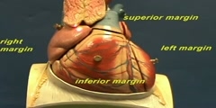 Heart Model I - Radiographic Margins