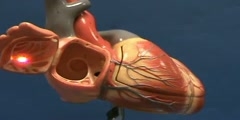 Heart Model II - Right Atrium