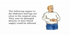 Abdominal Aortic Aneurysm pt 2