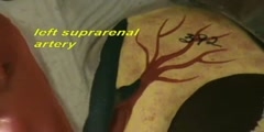 Paired Arteries of Abdominal Aorta
