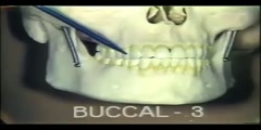 Introduction to Dental Anatomy