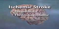 Human Brain Hemorrhage