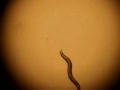 Young Hermaphrodite C. elegans worm