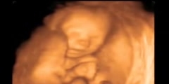Ultrasound of a 22 Week Old Baby