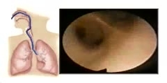 Respiratory System in Human