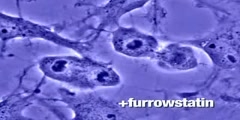 Furrowstatin: Part I