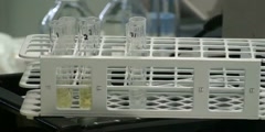 Alpha amylase assay-training video part 3