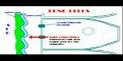 Transmission of Cystic fibrosis