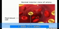Liver and gallbladder detoxification-part 2
