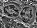 Meiosis drosophila spermatocyte