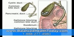 Natural way to remove gallstones