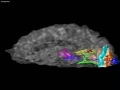 Connections of Visual System Under MRI