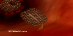 Nanobots in revoming clogs