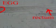 C.elegans micro-injection