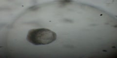 Physa marmorata (Pond snail) embryo rotation