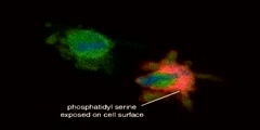PCD or Apoptosis