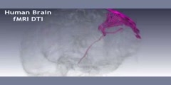 Human Brain Magnetic Resonance ( Diffusion Tensor Imaging)
