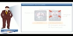 Pathophysiology of schizophrenia