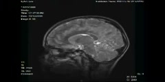 Functional Magnetic Resonance Imaging FMRI