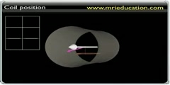 Working of Magnetic Resonance Imaging (MRI)