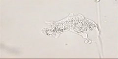 Amoeba Phagocytosis