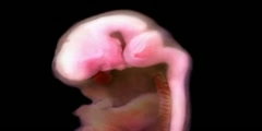 Fetal Brain Development