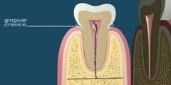 Medical Animation of a tooth anatomy