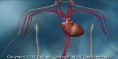 Circulatory mechanical support