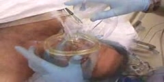 Intubation via the Oesophagus