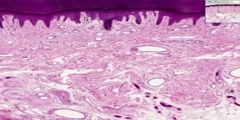 Thick skin histology