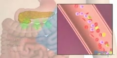 Type 2 Diabetes Mechanism in Animation  - Scientific Video and  Animation Site