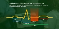 Placement of ECG Leads