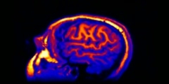 Human Brain  MRI