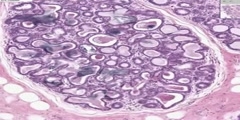 Active Breast histology