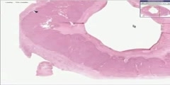 Part 2 of the histology of Corpus Luteum