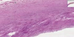 Large Artery Histology