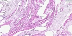 Female Urethra Histology
