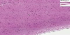 Aorta Histology