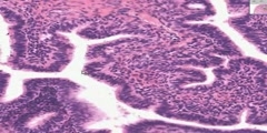 Fallopian Tube Histology