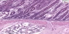 Histology of Duodenum