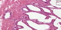 Seminal Vesicles Histology
