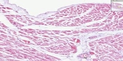 Heart Cardiac Muscle Histology