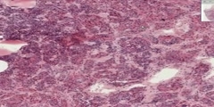 Pituitary Histology