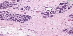 Inactive Breast Histology