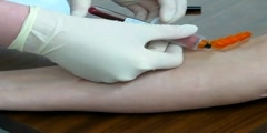 Venipuncture; Drawing Blood Sample